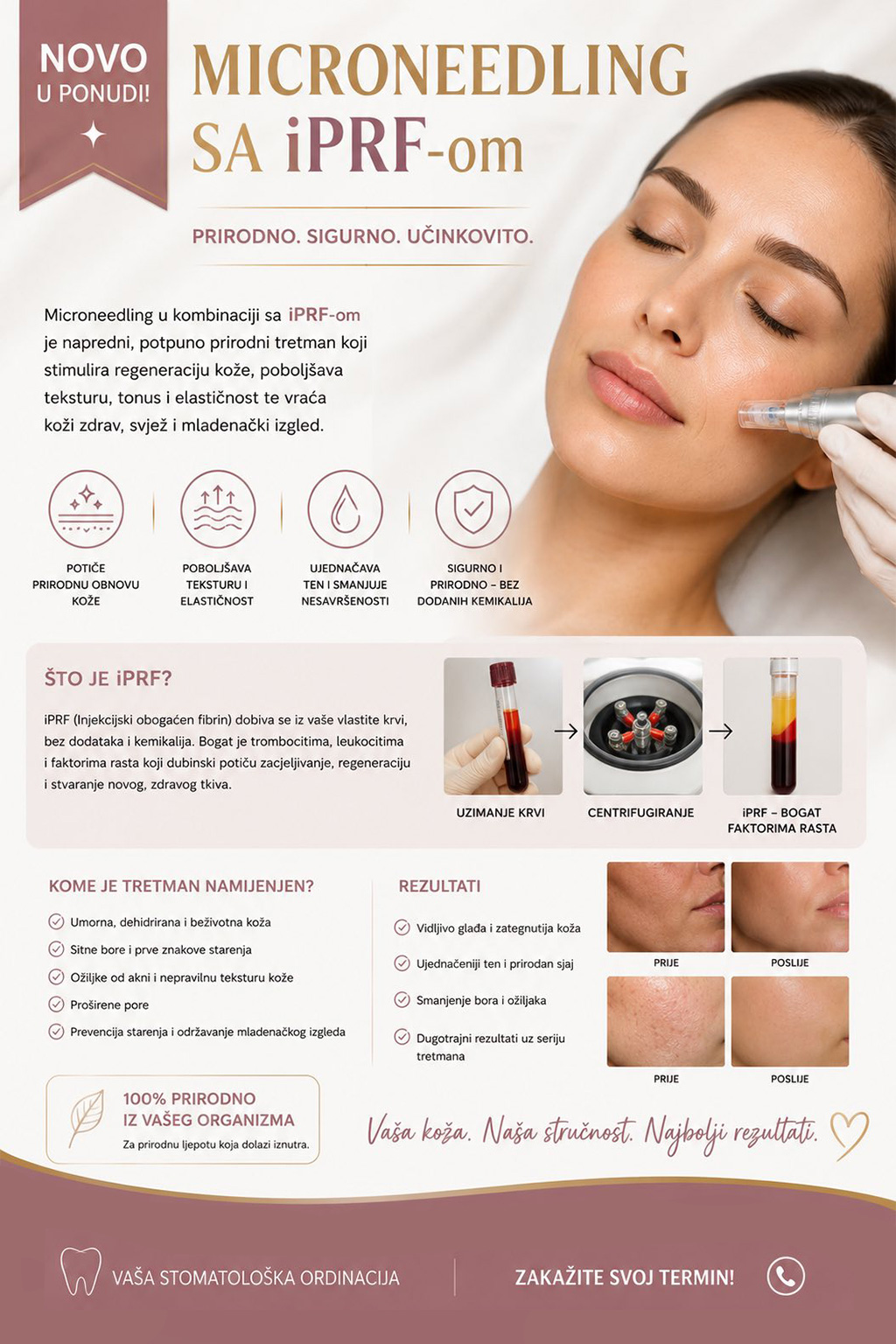 microneedling web